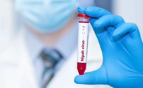 American Cancer Society adds blood test to colon screening