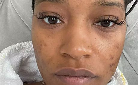 Keke Palmer Says Her Childhood Was the "Darkest" Time of Her Life and That Fame Traumatized Her