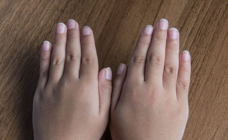 What your nails are, and are not, telling you about your health