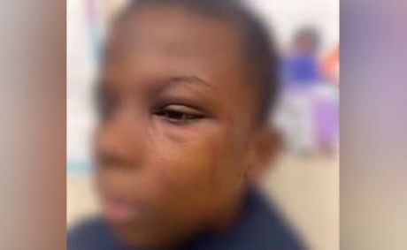 Black Mom Blames Chicago Public Schools, Says Teacher Assaulted Her 12-Year-Old Son