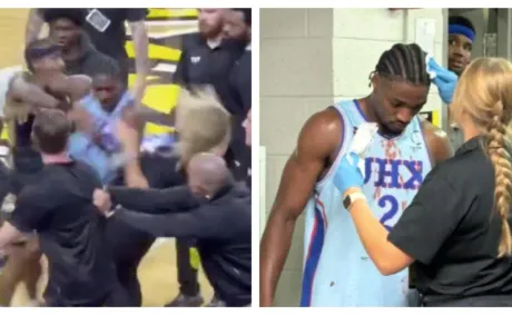 Woman Left with ‘Gnarly’ Broken Nose In Bloody Brawl at TBT Basketball Tournament