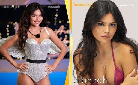 ‘Love Island USA’ Season 8 Casa Amor Bombshell Alannah Keyser Faces Backlash Over Resurfaced Clip Allegedly Showing Racial Slur
