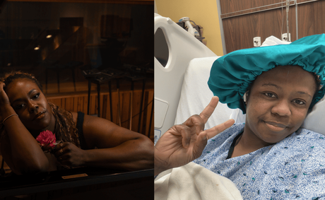 A Decade of Ignored Fibroid and Endometriosis Pain