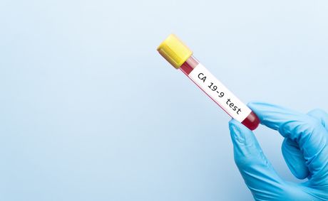 7 breast cancer types and why your diagnosis details matter