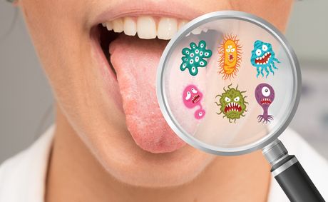 Could white tongue spots be a sign of something serious?