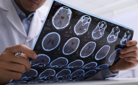 UTI symptoms people with multiple Sclerosis shouldn’t ignore