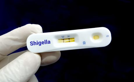 What to know about 2 new STIs spreading this summer