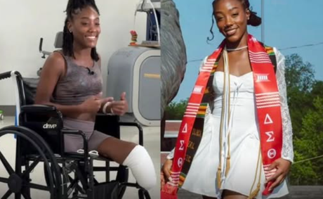 22-Year-Old Loses Both Legs on Graduation Cruise After Staff Allegedly Pressured Her to Drink and Swim