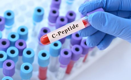 Are peptide injections actually safe or just a wellness fad?