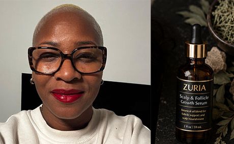 Black Woman Entrepreneur Turns Personal Hair Struggle into Luxury Botanical Brand Redefining Scalp Care